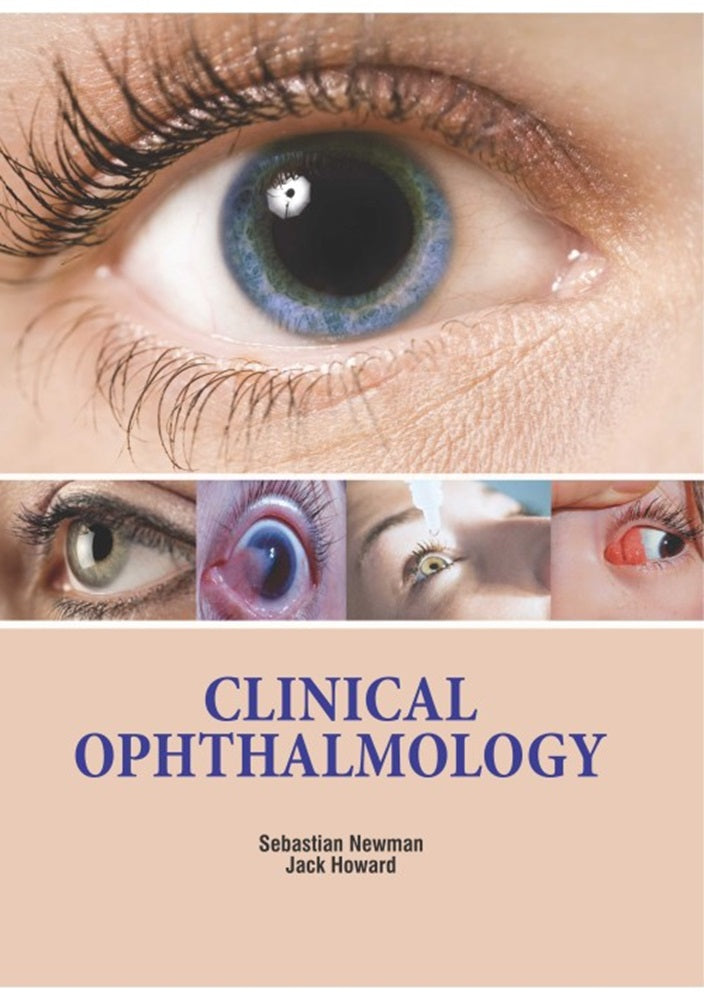 Clinical Ophthalmology - Sebastian Newman - 9781788824453 - Medplus Clinical Ophthalmology - Sebastian Newman - 9781788824453 - Medplus