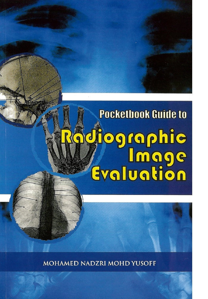 Pocketbook Guide to Radiographic Image Evaluation - Mohamed Nadzri Mohd Yusoff - 9789673632237 - UiTM